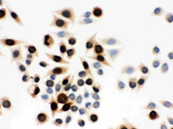 Immunocytochemistry analysis of Cyclin A